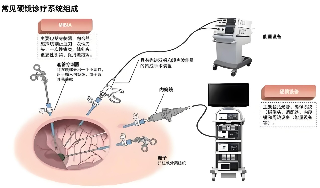 濾光片 常見(jiàn)硬鏡診療系統(tǒng)組成