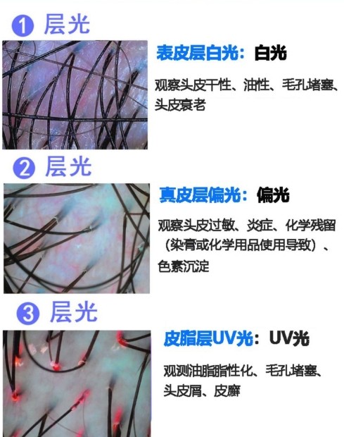 不同光對(duì)頭發(fā)的觀測(cè)效果 不同光對(duì)頭發(fā)的觀測(cè)效果