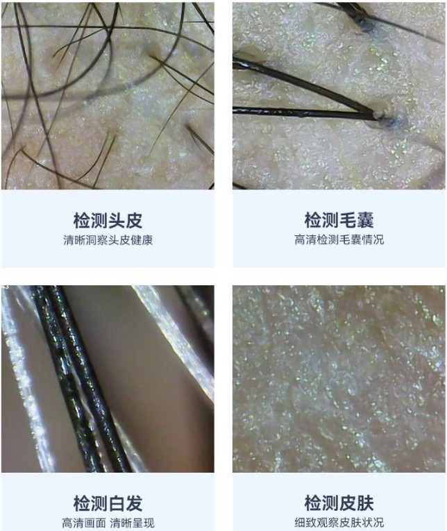 頭皮檢測(cè)儀的功能效果 頭皮檢測(cè)儀的功能效果
